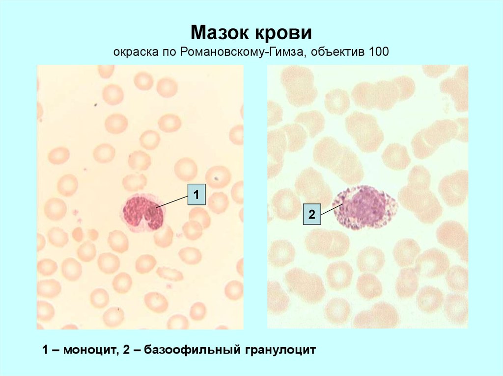 Окраска мазка по романовскому гимза. Окраска мазка крови по методу Романовского Гимза. Мазок крови окраска Азур 2 эозином по Романовскому Гимзе.