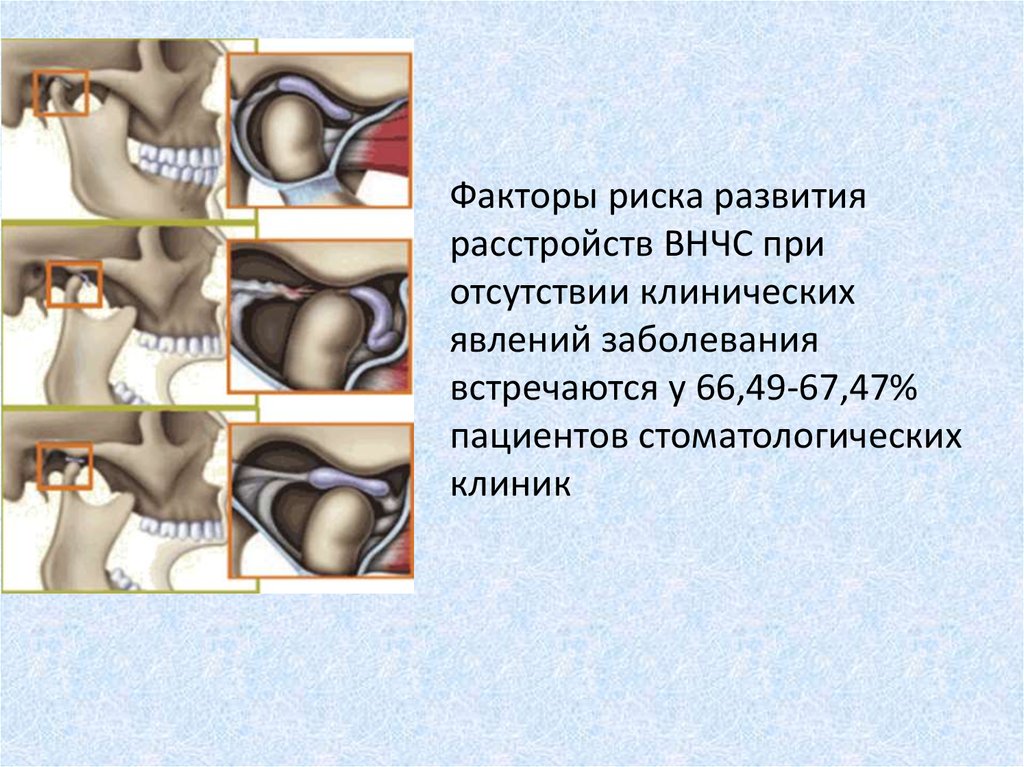 Схема патогенеза развития дисфункции внчс