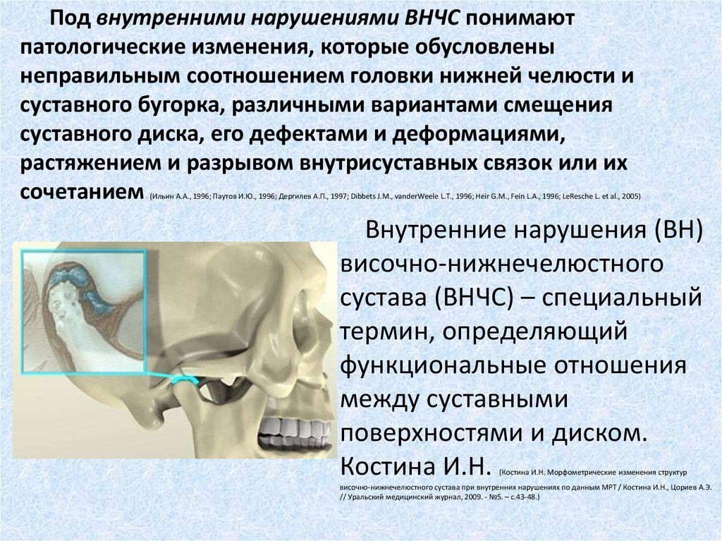 Нарушений височно нижнечелюстного сустава