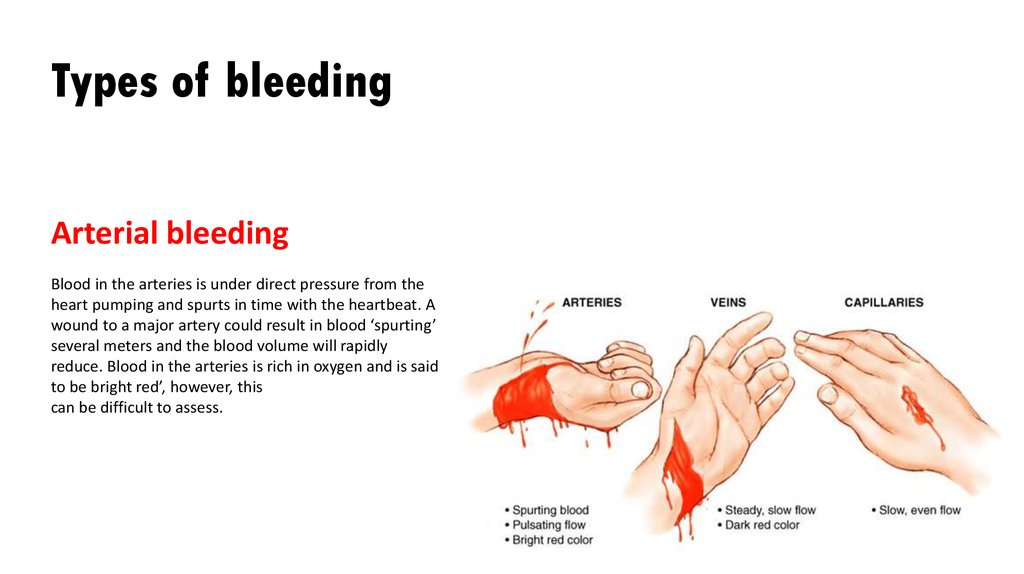First Aid. Procedures - online presentation