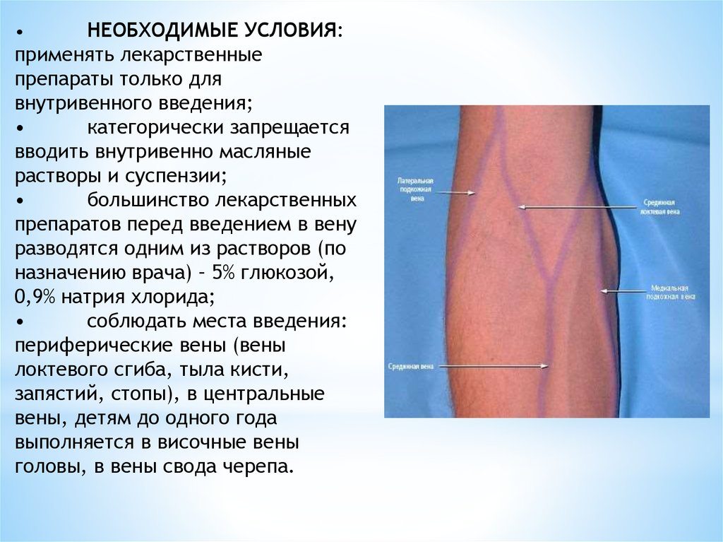Локтевой сгиб. Вены локтевого сгиба для инъекции. Введение лекарства в локтевой сгиб. Масляный раствор в Вене.