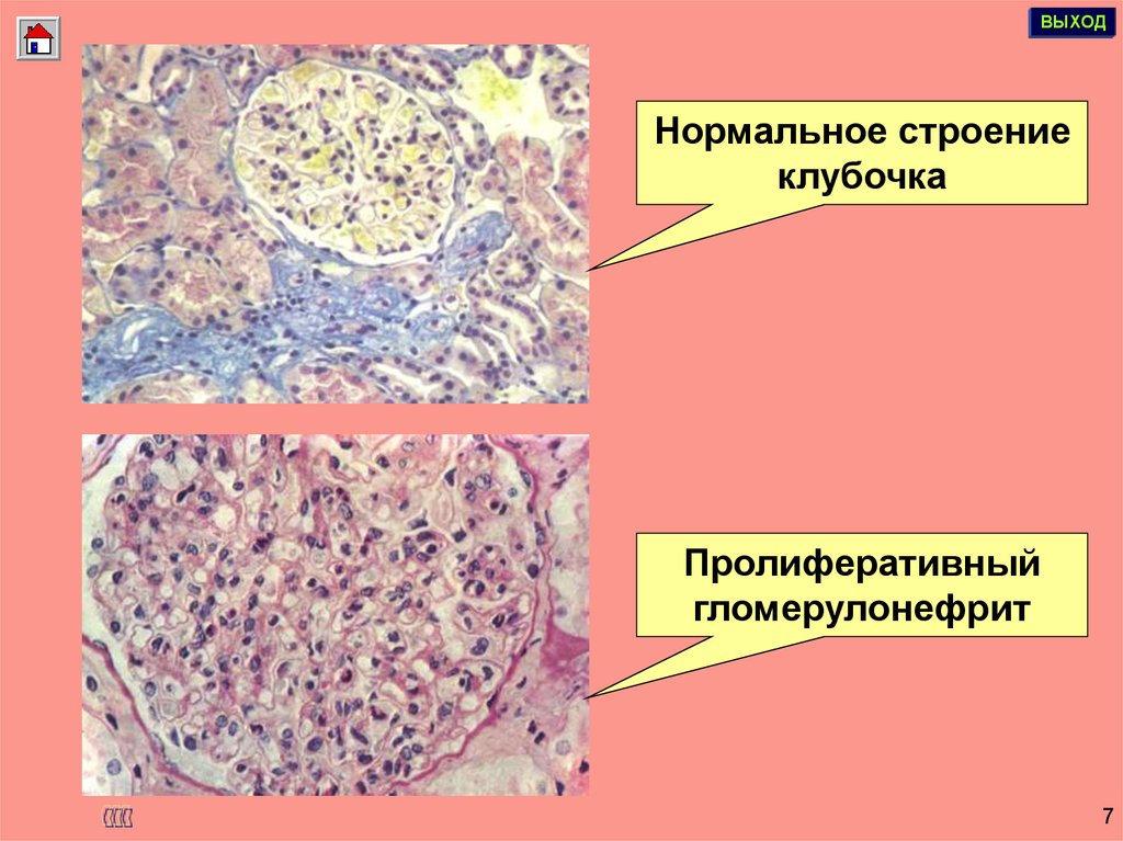 Нормальное строение