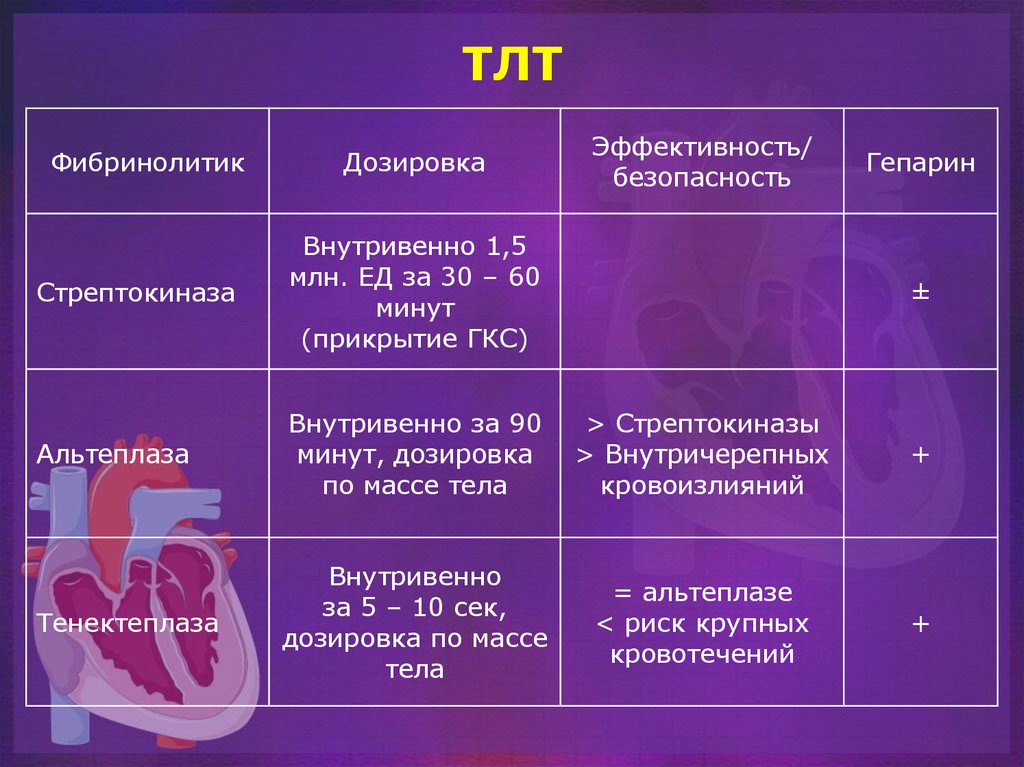 История болезни острый инфаркт миокарда