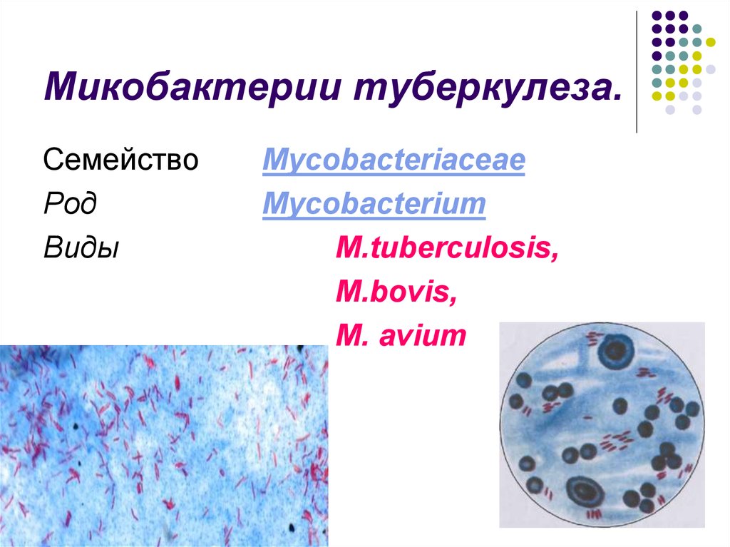 Рисунок возбудителя туберкулеза