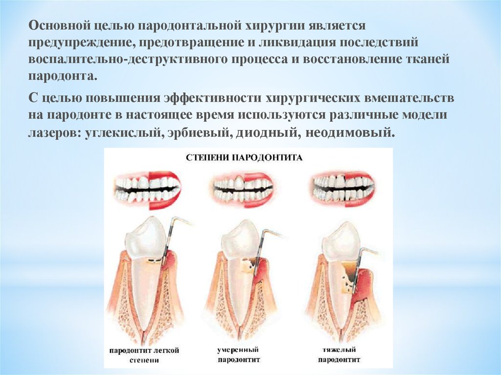 Общие принципы пародонтальной хирургии презентация