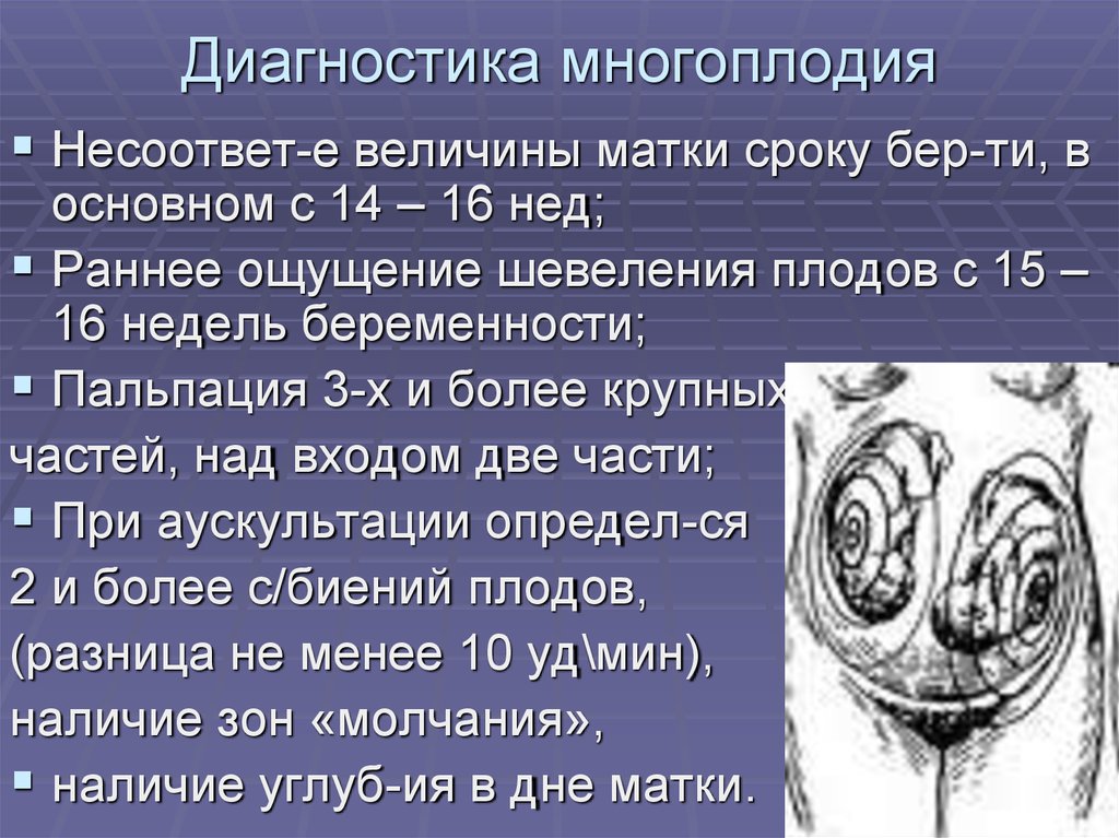 Многоплодная беременность презентация