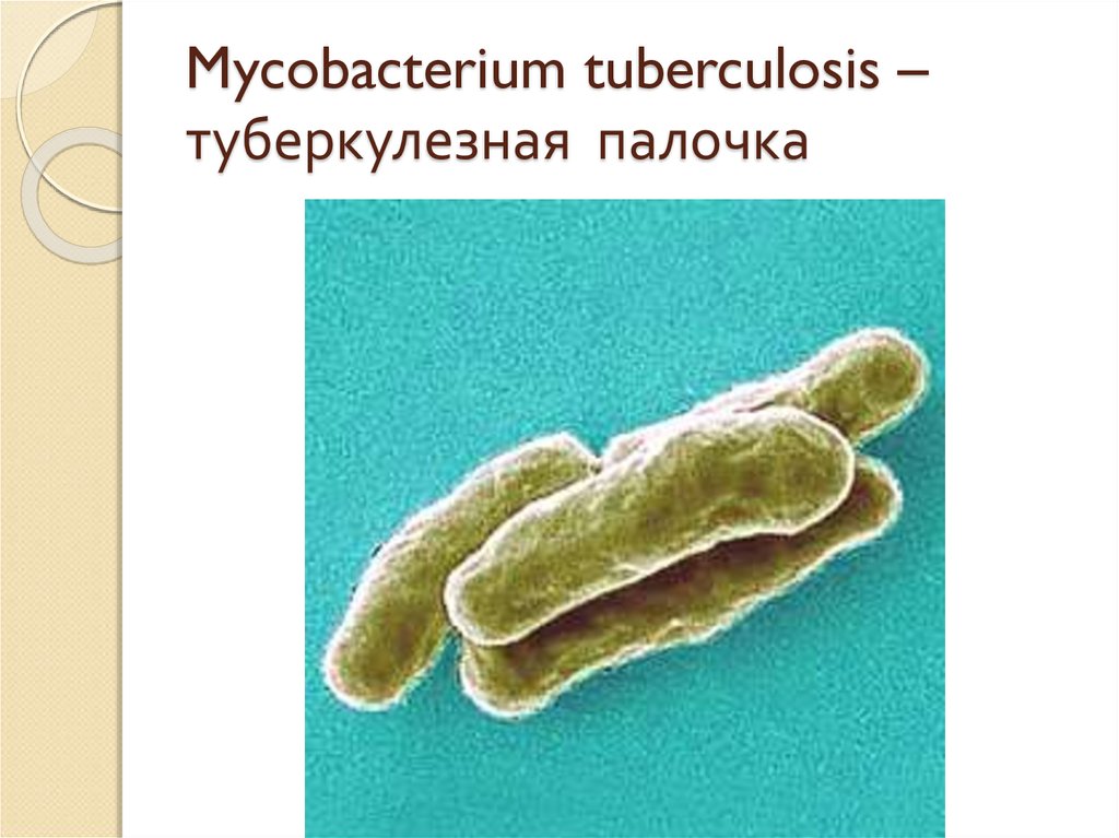 Туберкулез tuberculosis. Микобактерия туберкулеза палочка Коха. Микобактерия палочки Коха. Палочка Коха туберкулез. Палочки – микобактерия туберкулеза.