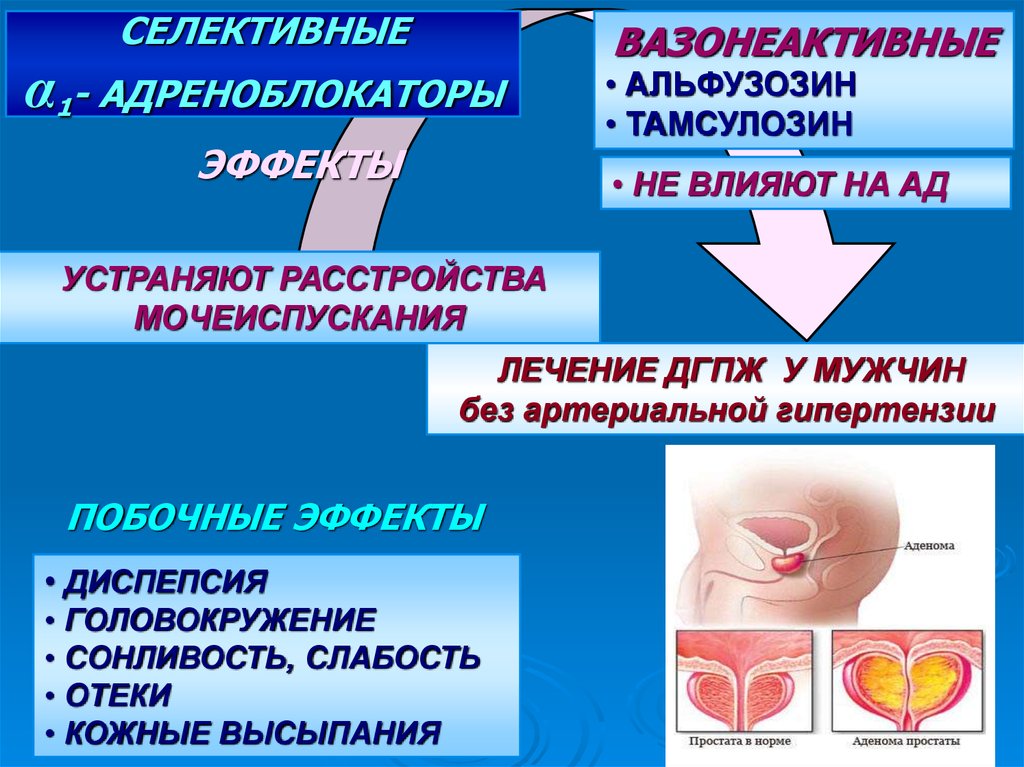 Что значит дгпж. Гиперплазия предстательной железы. Аденома предстательной железы и артериальная гипертензия. ДГПЖ лечение. Артериальная гипертензия и аденома предстательной железы препарат.