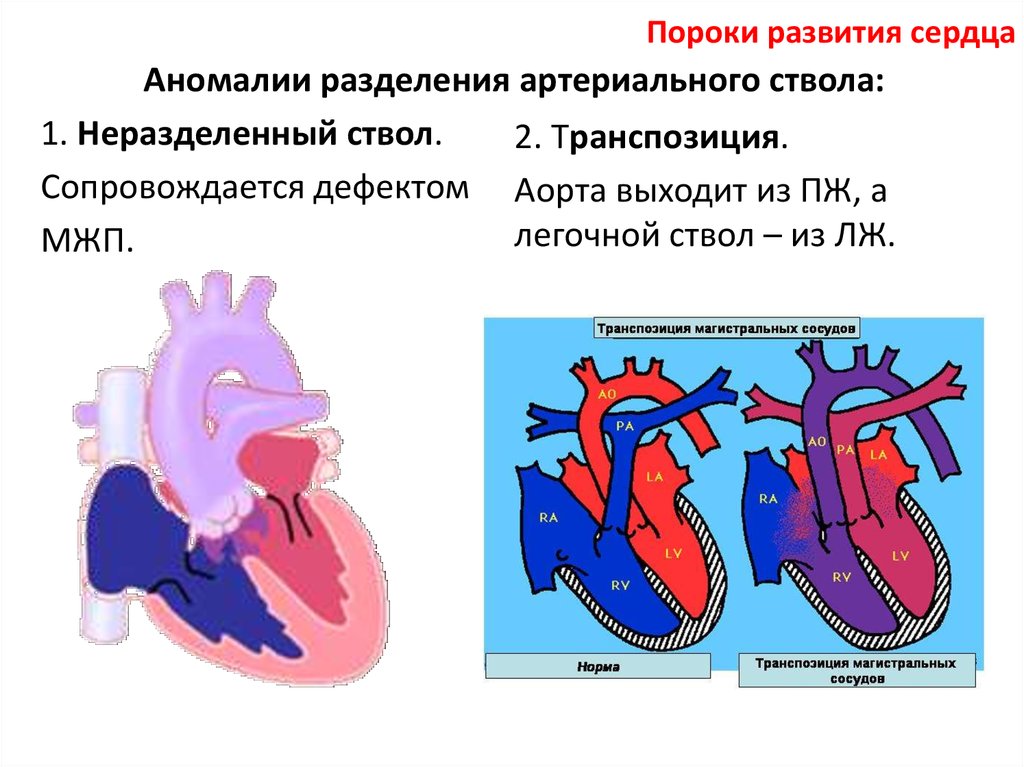 Малые аномалии развития сердца у детей презентация