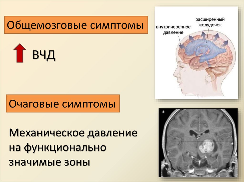 Возрастные изменения головного мозга