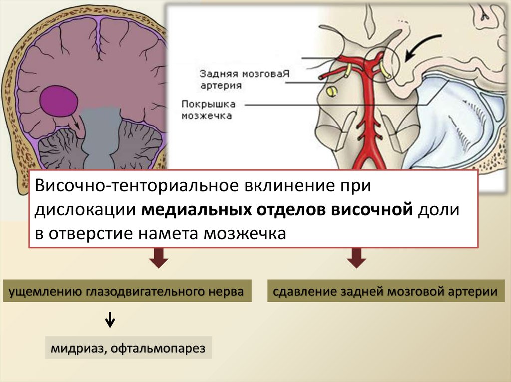 Опухоли нервной системы презентация