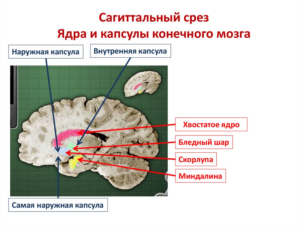 Ядра конечного мозга. Базальные ядра внутренняя капсула. Базальные ганглии Сагиттальный срез. Строение внутренней капсулы головного мозга схема. Базальные ядра головного мозга капсула.