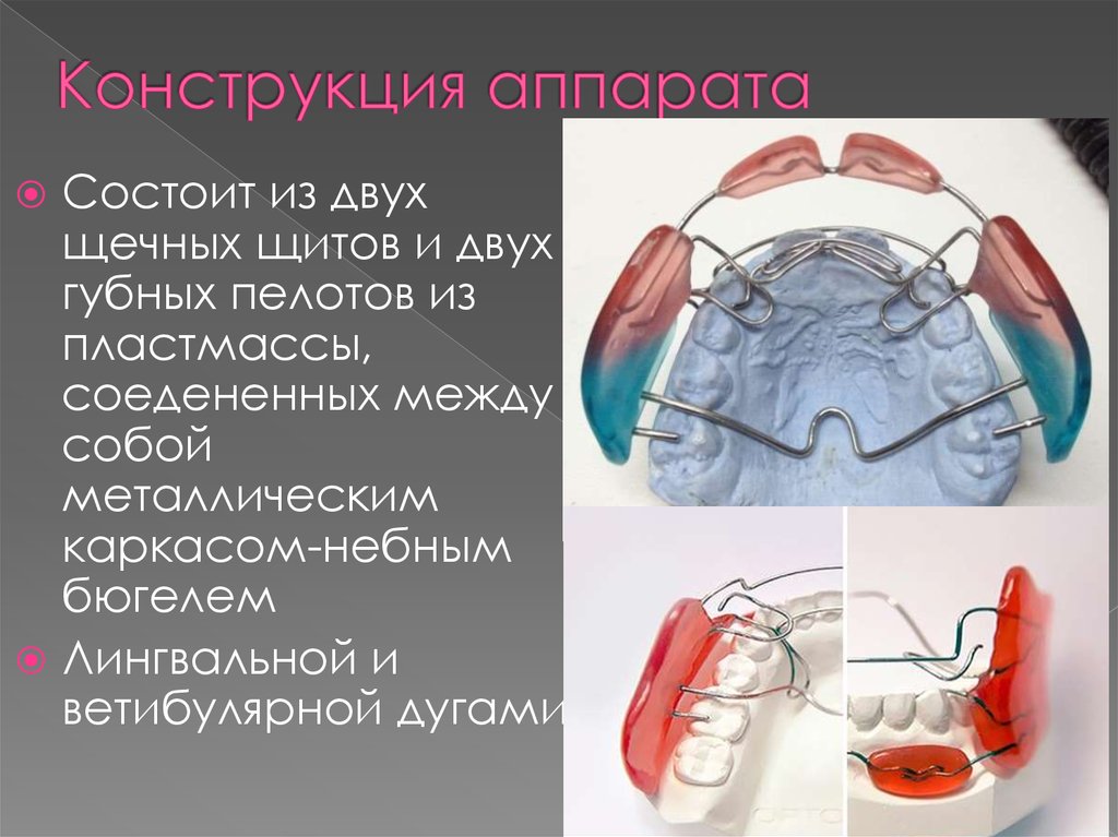Ортодонтические аппараты презентация