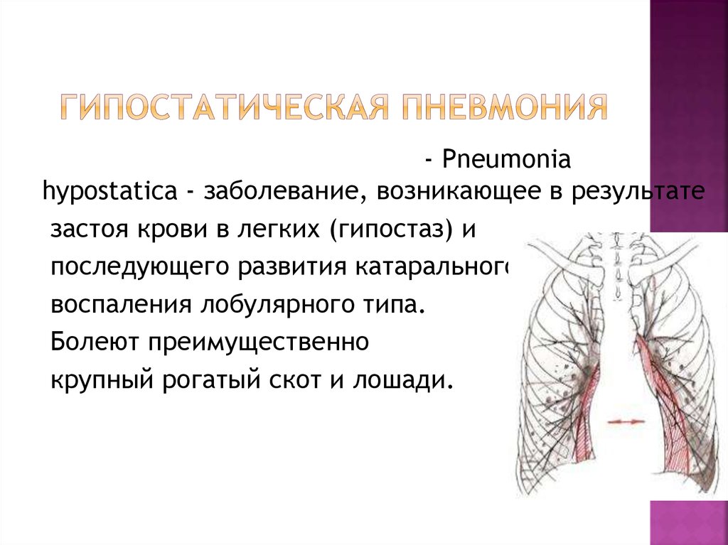 Гипостатические изменения в легких