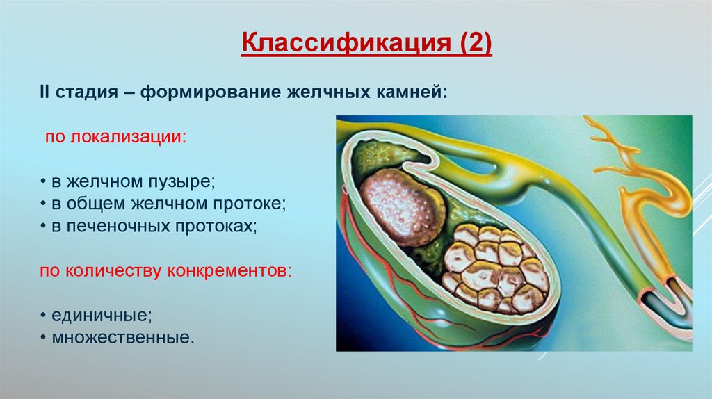 Узнать состав камней желчном. Классификация камней желчного пузыря. Локализация желчных камней. Классификация конкрементов желчного пузыря. Пигментные камни в желчном пузыре.