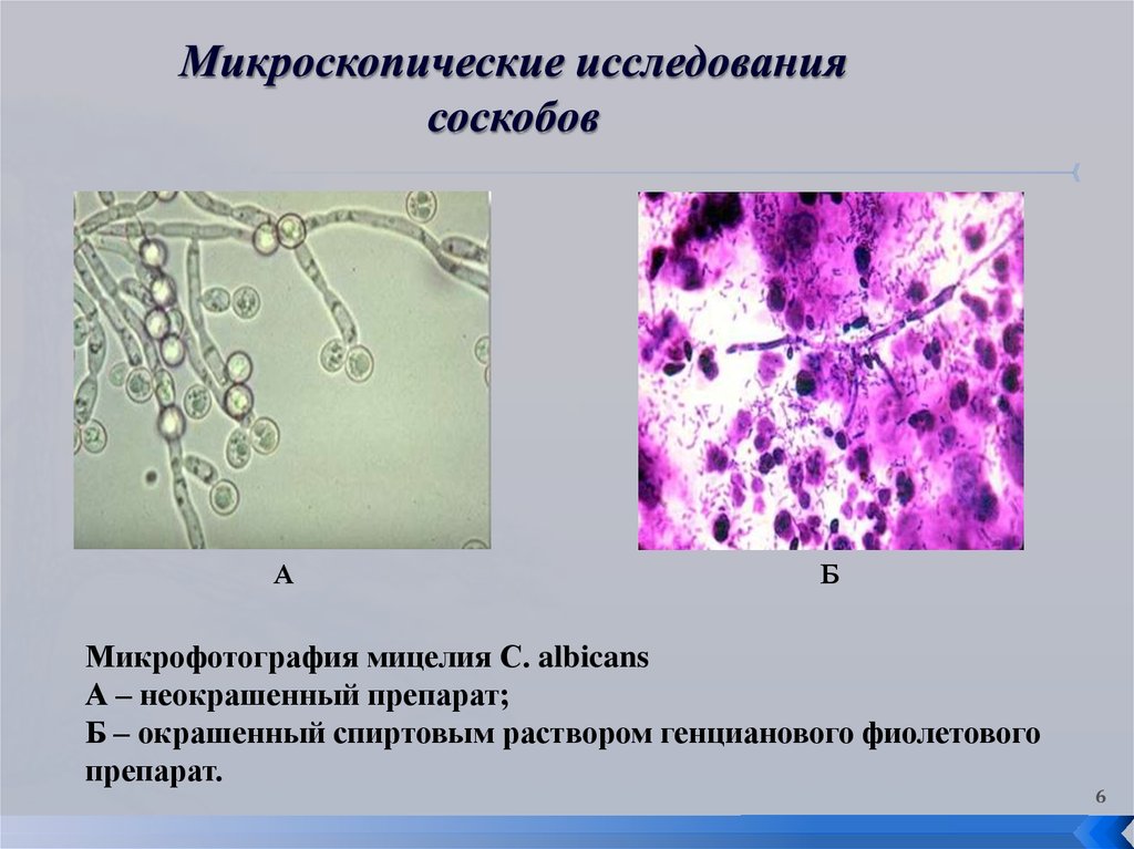 Обнаружены споры и мицелий. Грибы кандида микроскопия. Мицелий гриба микроскопия. Мицелий грибов кожи микроскопия. Грибы кандида альбиканс микроскопия.