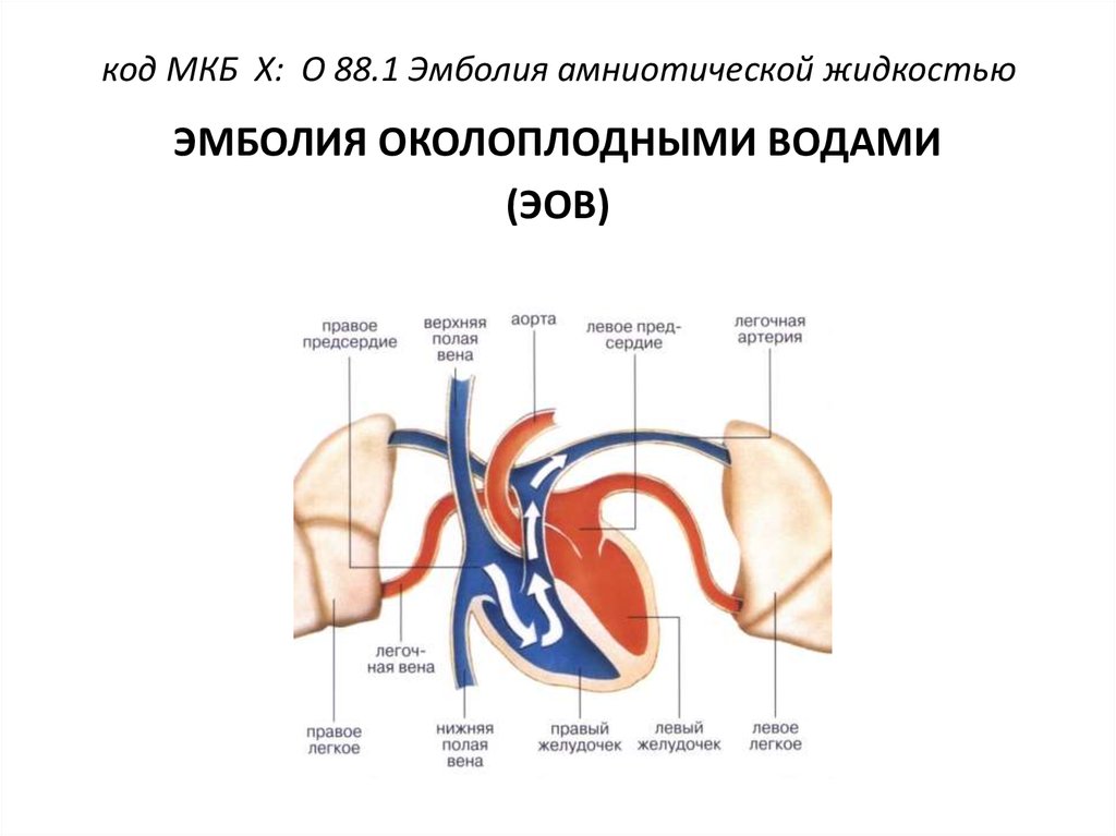 Эмболия околоплодными водами презентация