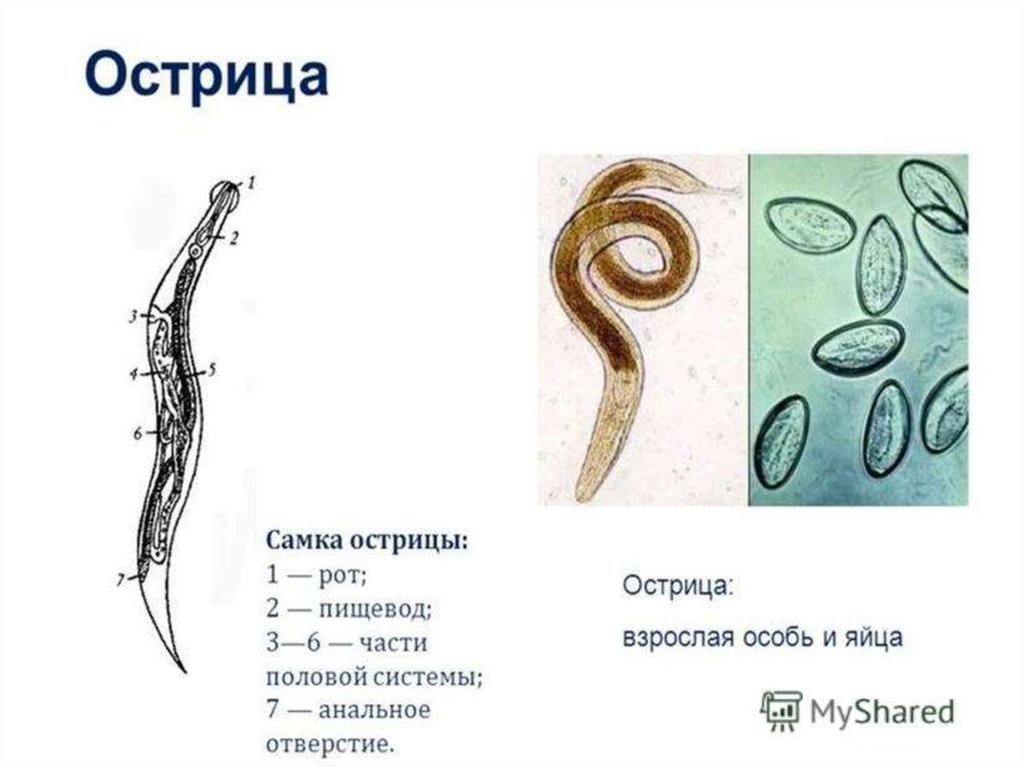 Энтеробиоз сколько. Острица детская строение. Аскариды, токсокары, острицы.. Enterobius vermicularis строение. Острица строение.