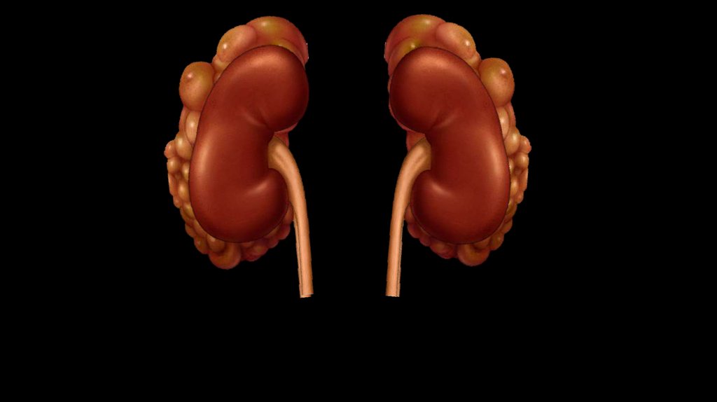 Что может пойти не так?