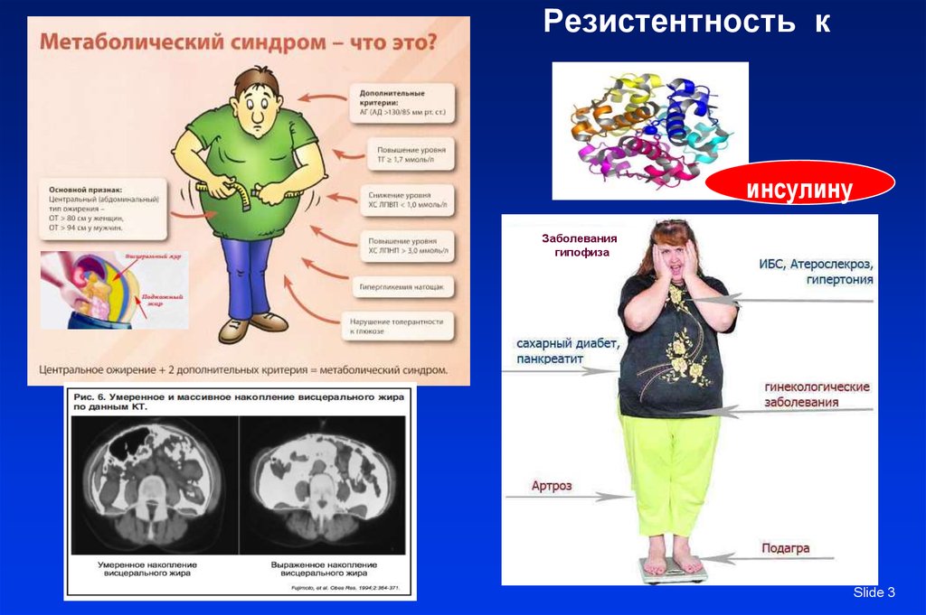 Проявлениями метаболического синдрома являются. Метаболический синдром гиперлипидемия. Синтропия метаболический синдром. Метаболический синдром инсулинорезистентности. Ожирение метаболический синдром.