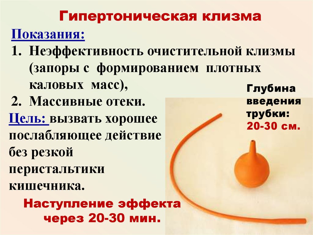 Газоотводная трубка вводится на глубину. Показания для постановки гипертонической клизмы. Очистительная клизма глубина введения наконечника. Постановка очистительной клизмы глубина введения. Постановка гипертонической клизмы схема.