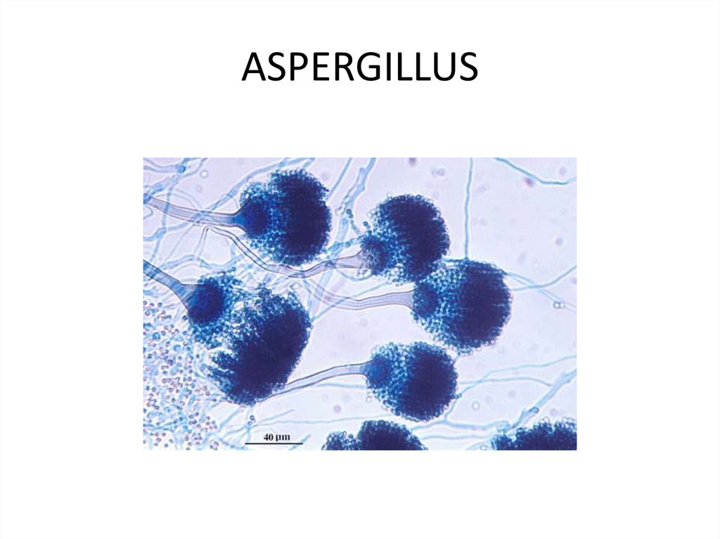 Аспергиллез микробиология презентация
