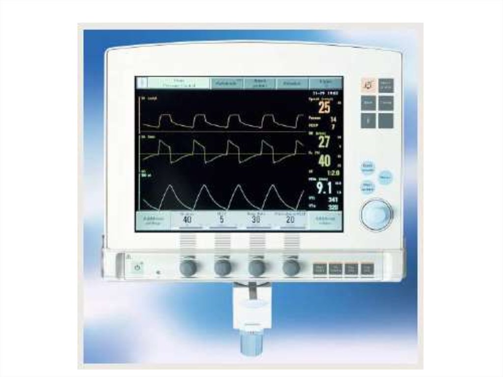 Экран прибора. Аппарат ИВЛ показатели на мониторе. Монитор аппарата ИВЛ. ИВЛ Сименс. Экран аппарата ИВЛ.