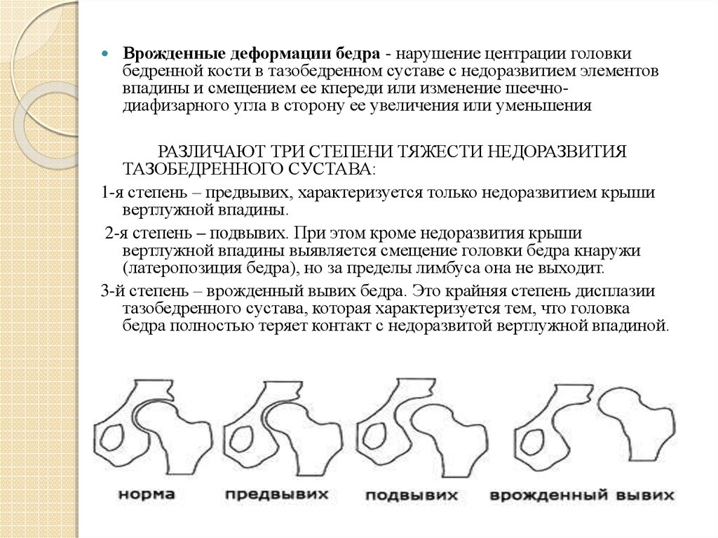 Презентация дисплазия тазобедренных суставов