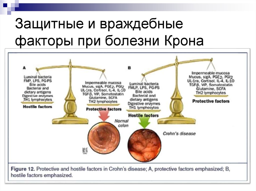 Болезнь крона терапия презентация