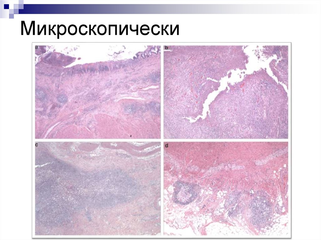 Болезнь крона терапия презентация