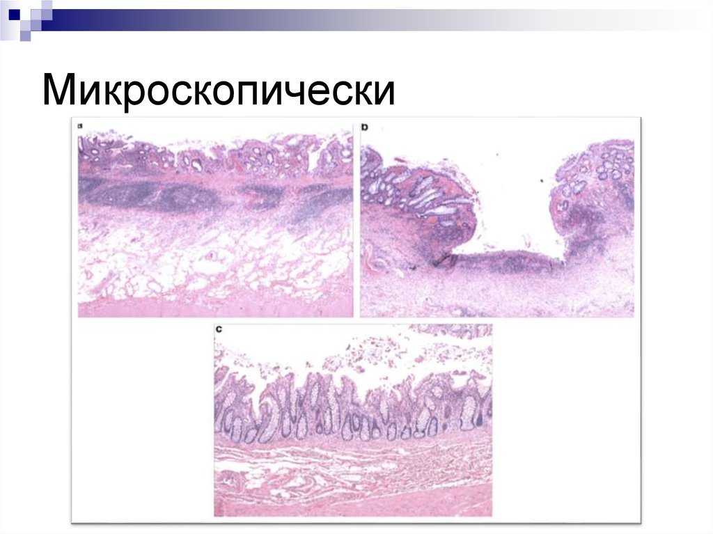 Микроскопически