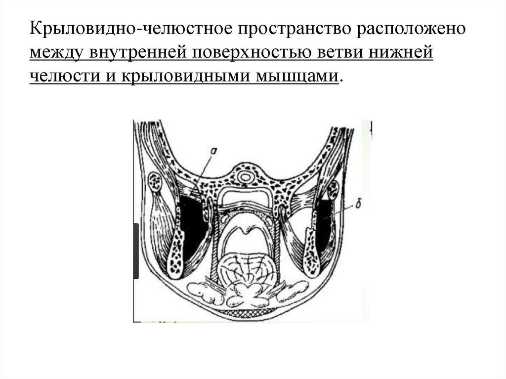 Абсцесс и флегмона поднижнечелюстной области презентация