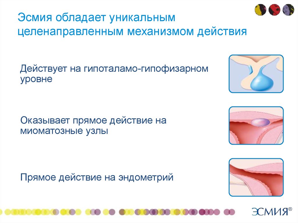 Новые возможности органосохраняющего лечения миомы матки - презентация .