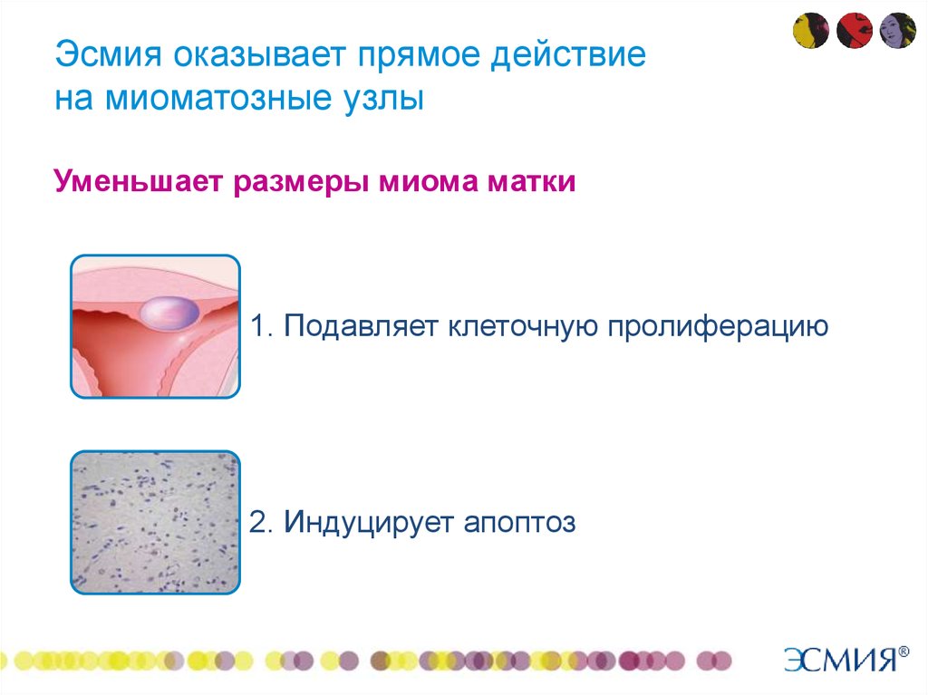 Новые возможности органосохраняющего лечения миомы матки - презентация .