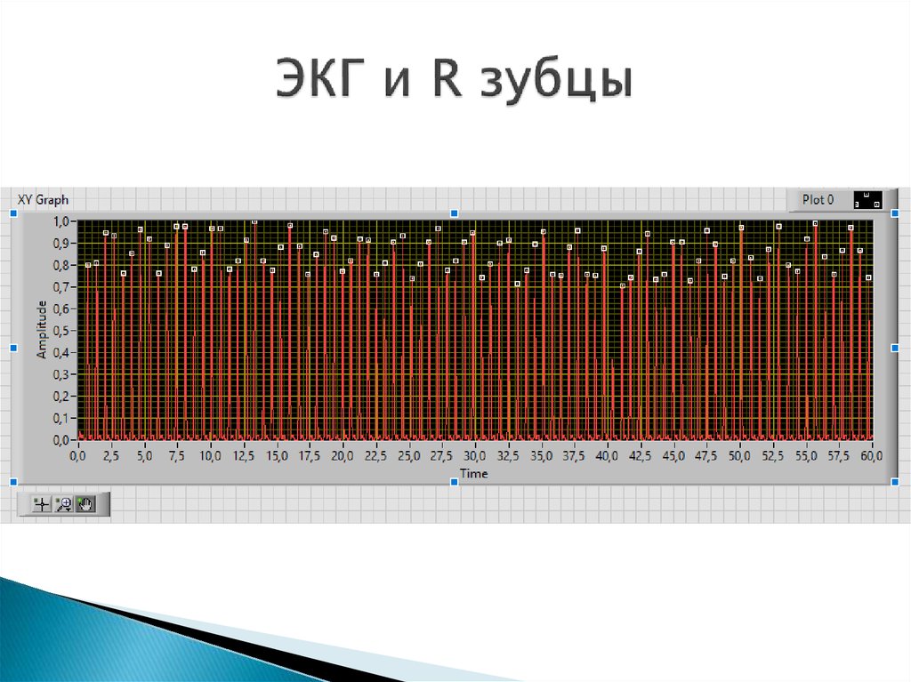 ЭКГ и R зубцы