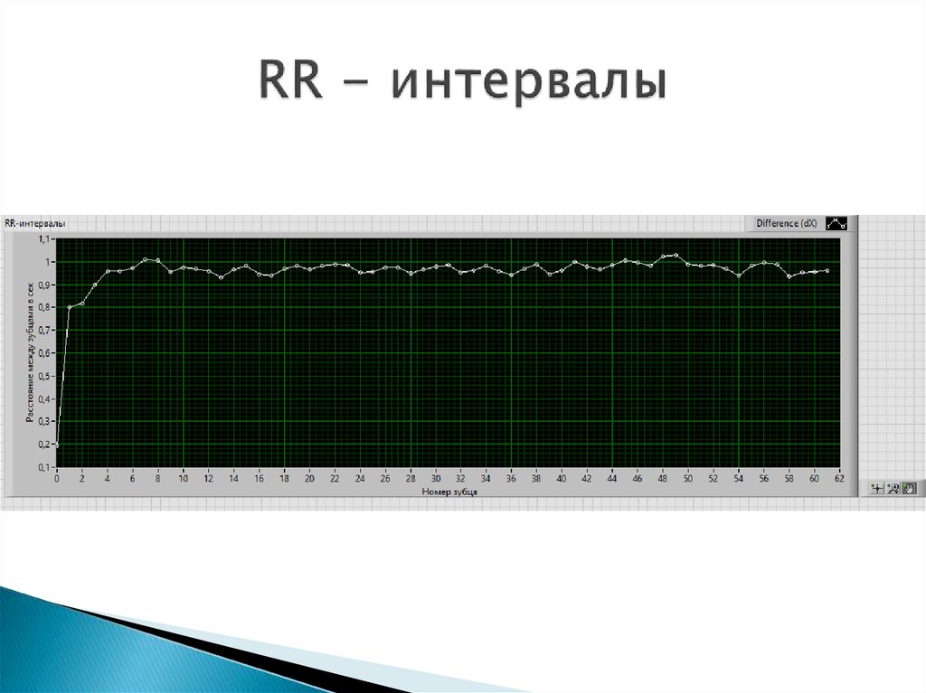 RR - интервалы