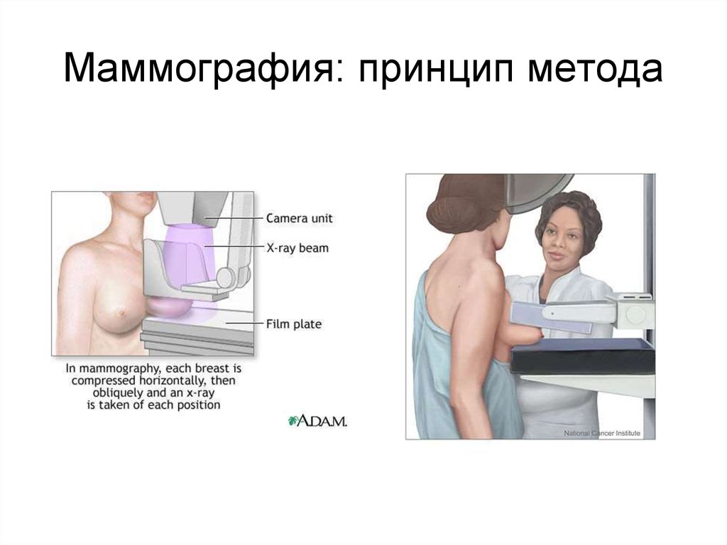 Маммография: принцип метода