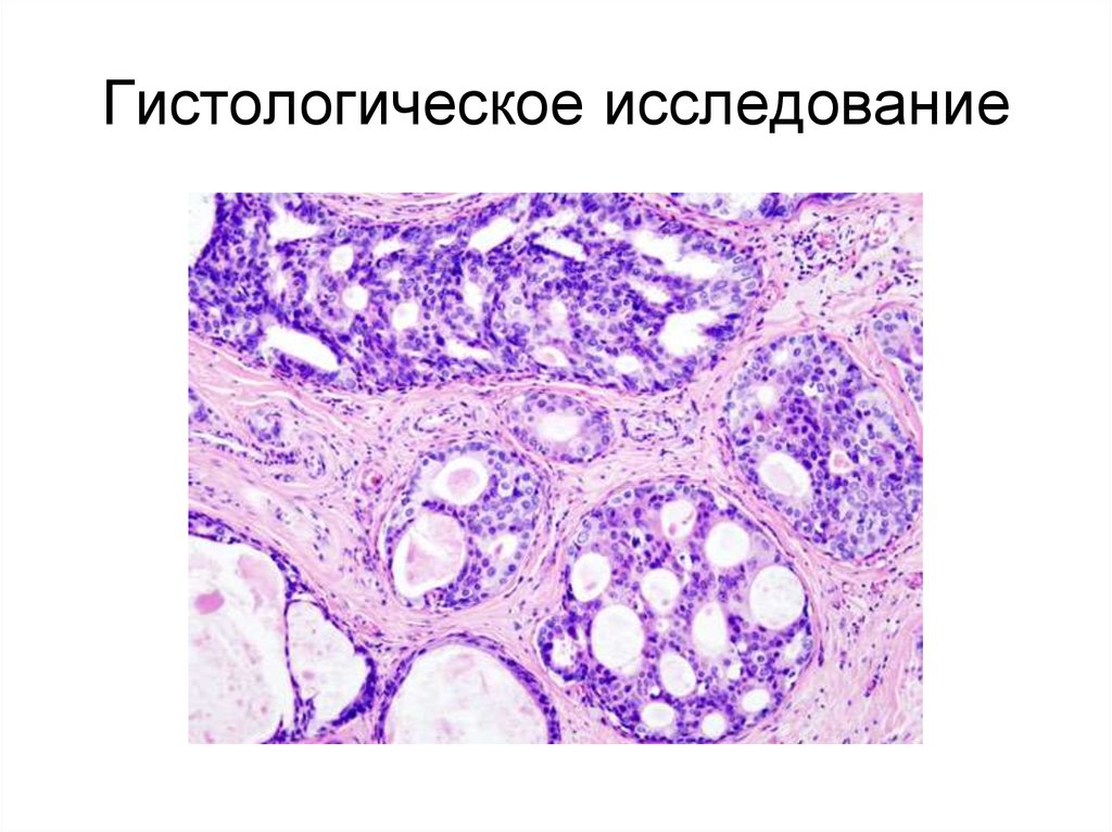 Гистологическое исследование. Гистологическое исследование молочной железы. Гистологический метод исследования. Гистологическое исследование картинки.