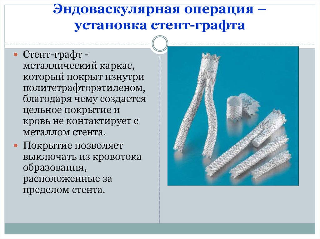 Операция установка. Стент графт. Установка стент графта. Стент-графт эндоваскулярный. Эндоваскулярная операция - установка стент-графта.