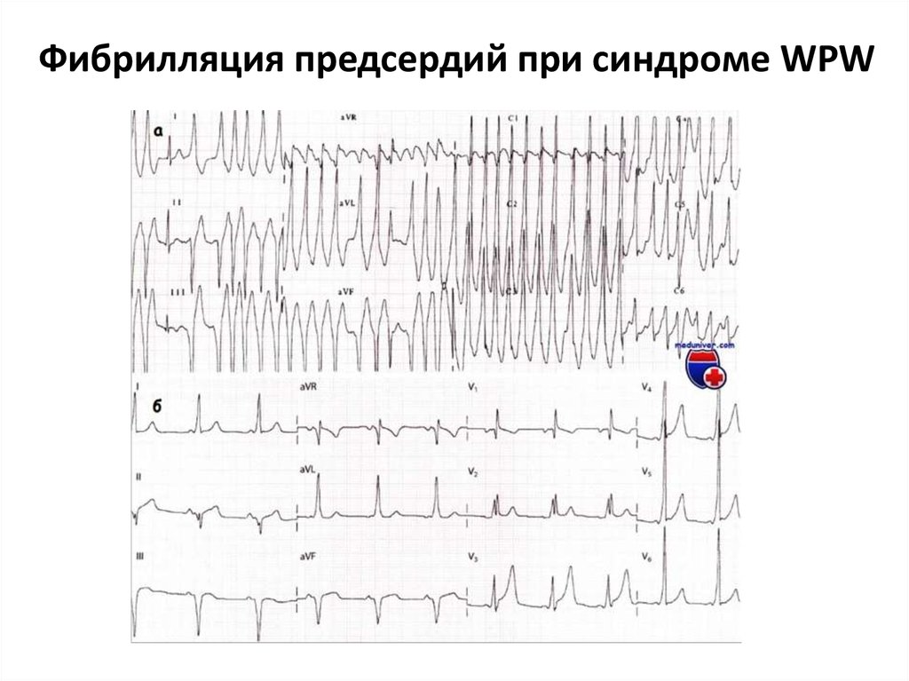 Журнал экг образец