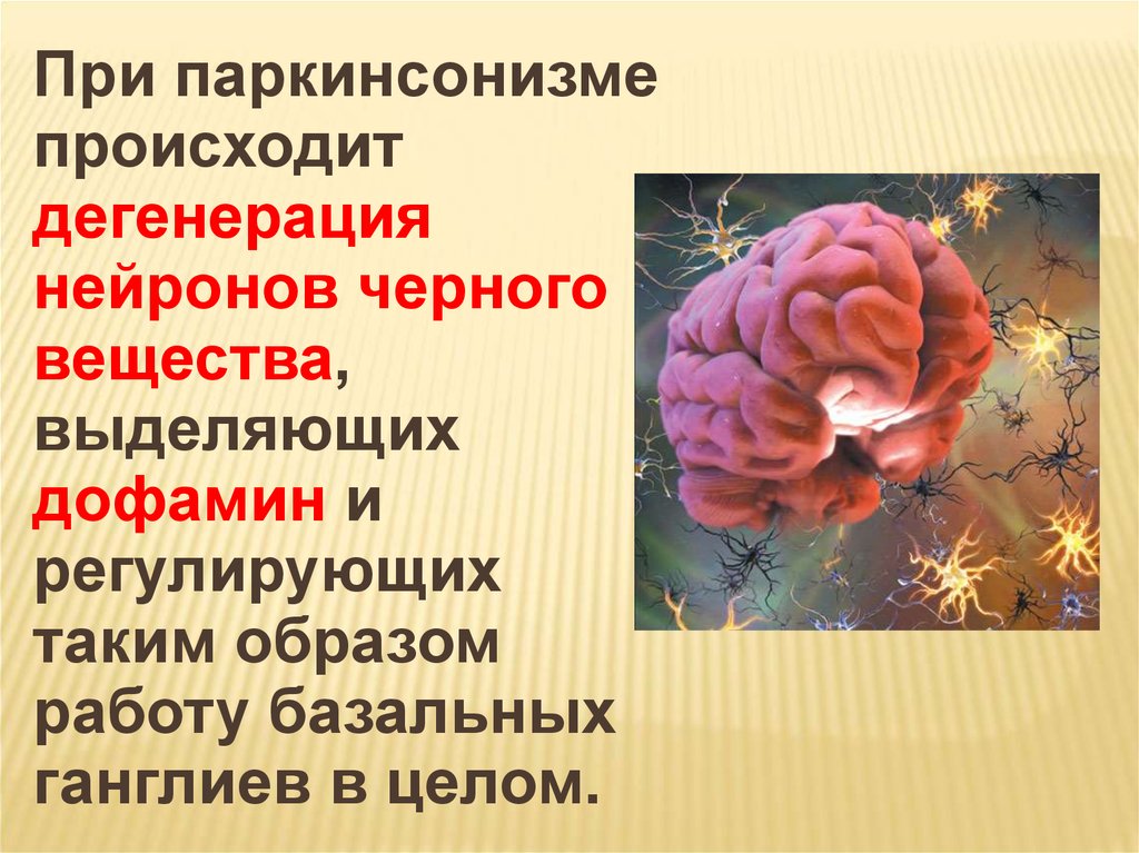 Паркинсонизм. Дофамин при паркинсонизме. Болезнь Паркинсона черная субстанция. Базальные ганглии при болезни Паркинсона.