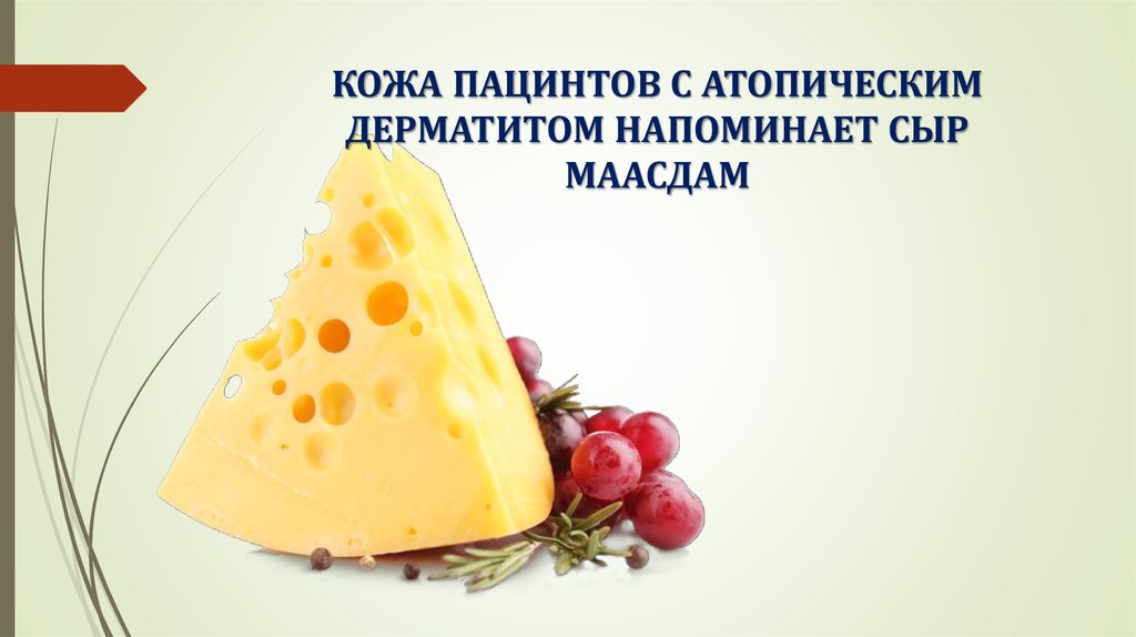 КОЖА ПАЦИНТОВ С АТОПИЧЕСКИМ ДЕРМАТИТОМ НАПОМИНАЕТ СЫР МААСДАМ