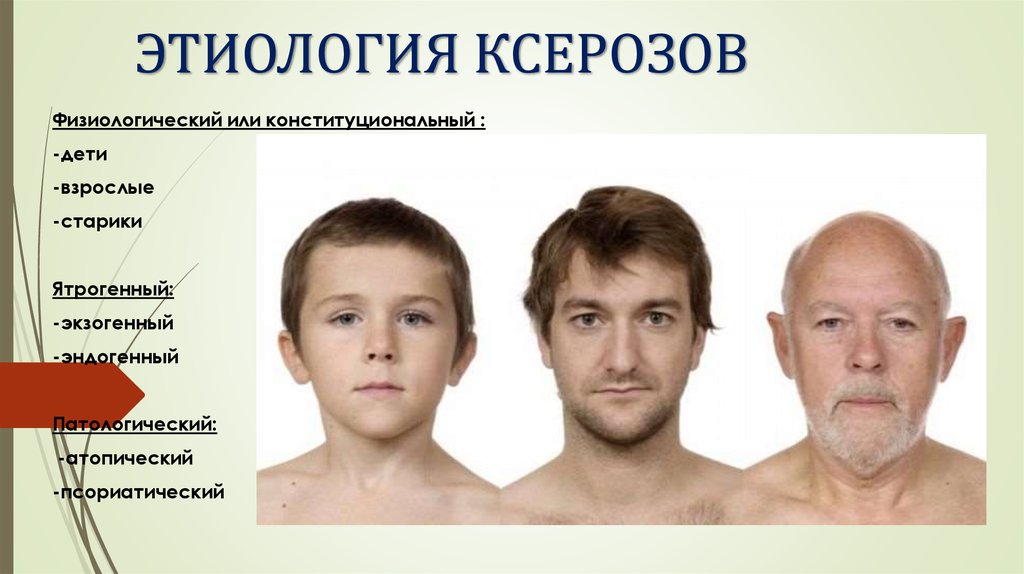 ЭТИОЛОГИЯ КСЕРОЗОВ