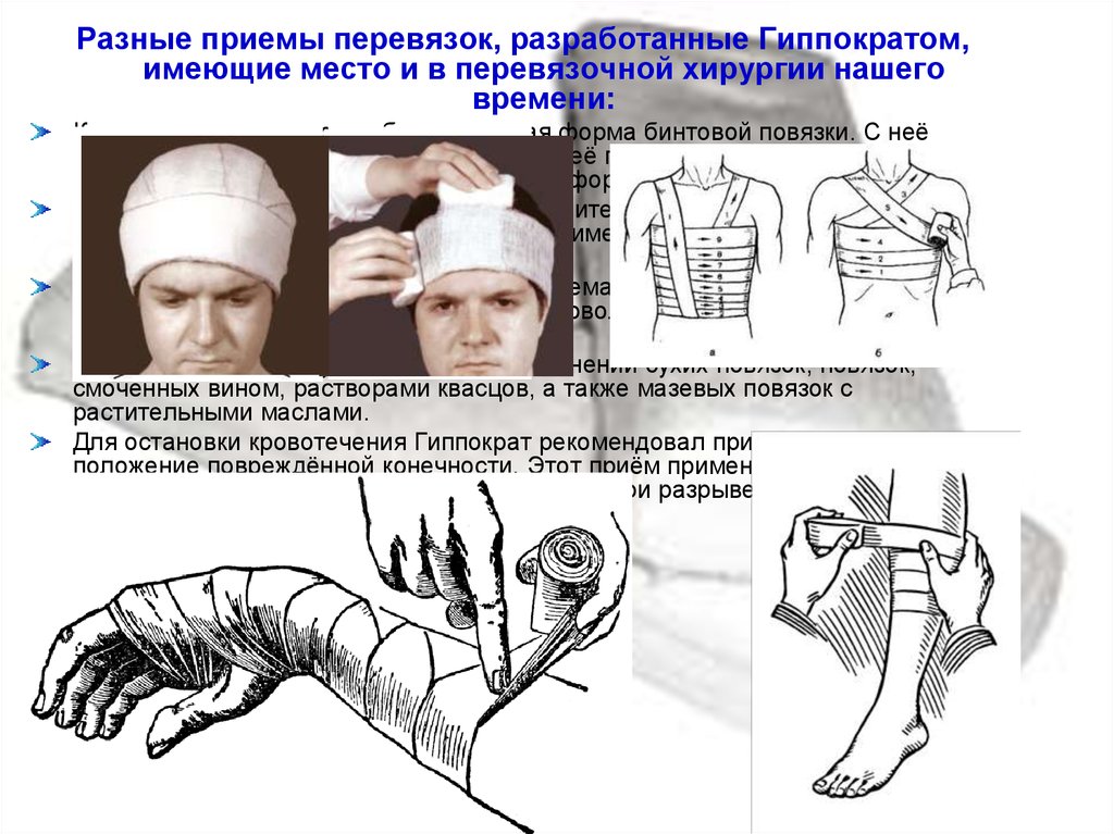 Инструментальная перевязка чистой раны. Перевязка после операции алгоритм. Алгоритм инструментальной перевязки гнойной раны.. Повязки хирургия.