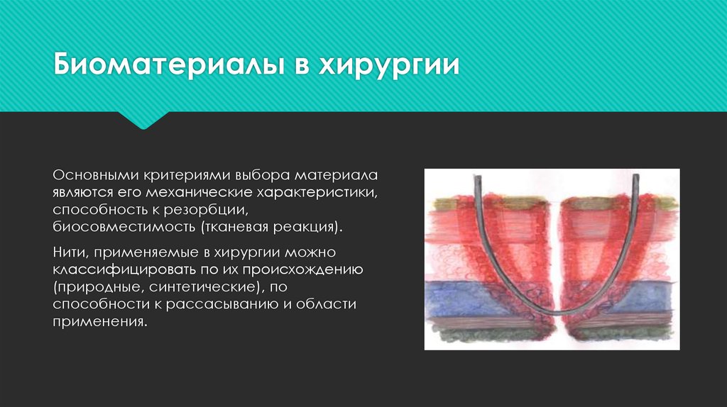 Основной материалом является. Нанотехнологии в хирургии. Биоматериалы в медицине. Классификация биоматериалов. Возобновляемые материалы биоматериалы.