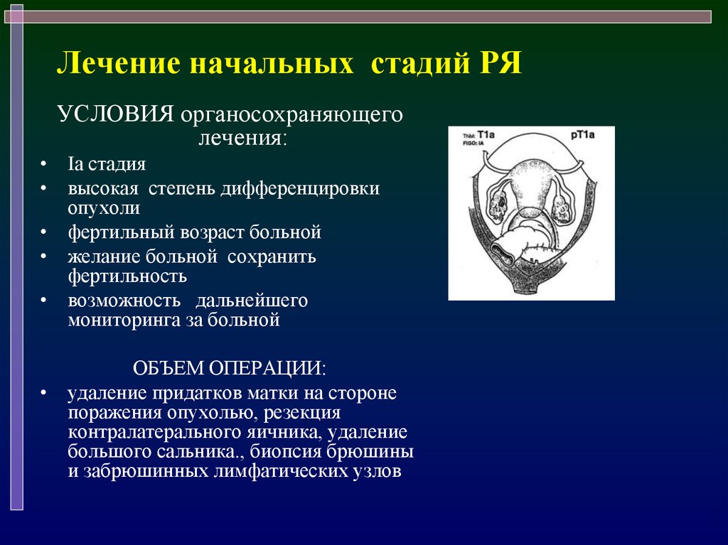 Лечение начальной стадии. Онкологические аспекты эндометриоза. Органосохраняющие операции при эндометриозе презентация.