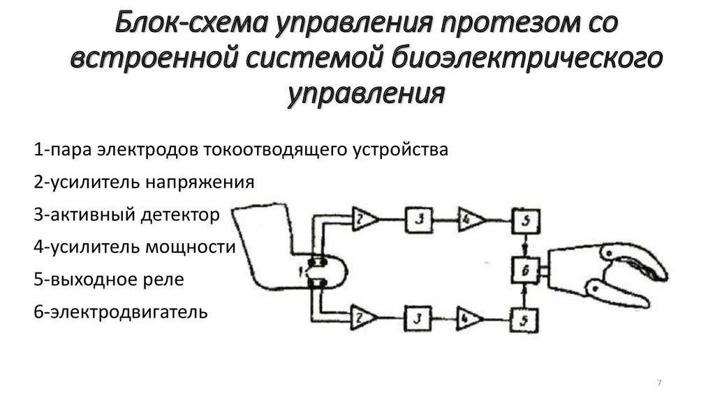 Схема бионического протеза