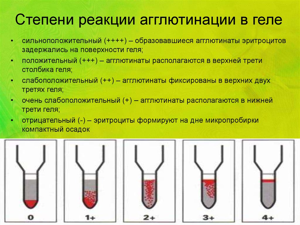 Степень реакции. Оценка реакции агглютинации. Реакция агглютинации оценка результатов. Реакция агглютинации в геле. Стадии агглютинации.