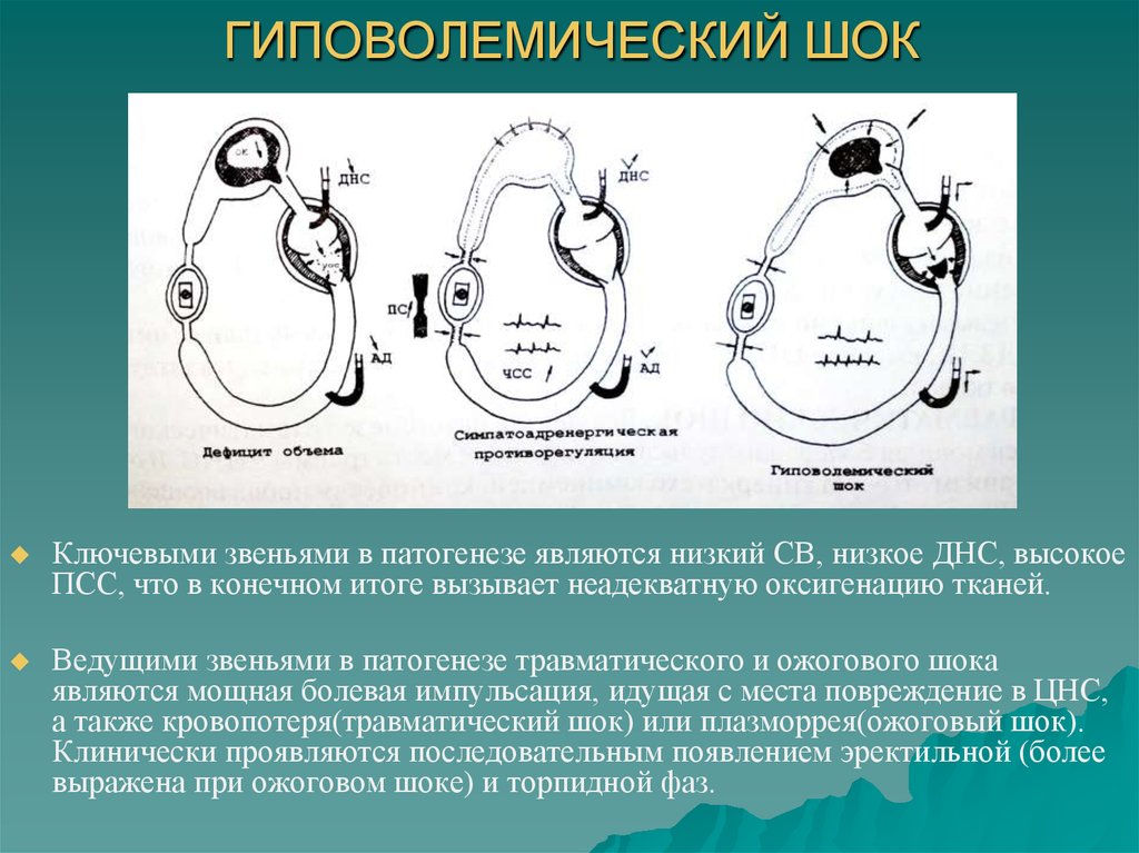 Гиповолемический шок анестезиология и реаниматология презентация