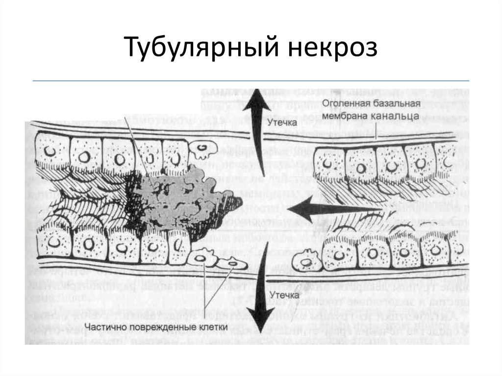 Крио на згт с блокадой схема